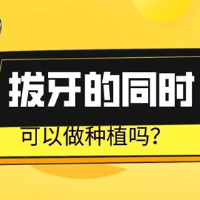 拔牙的同时可以种植吗？